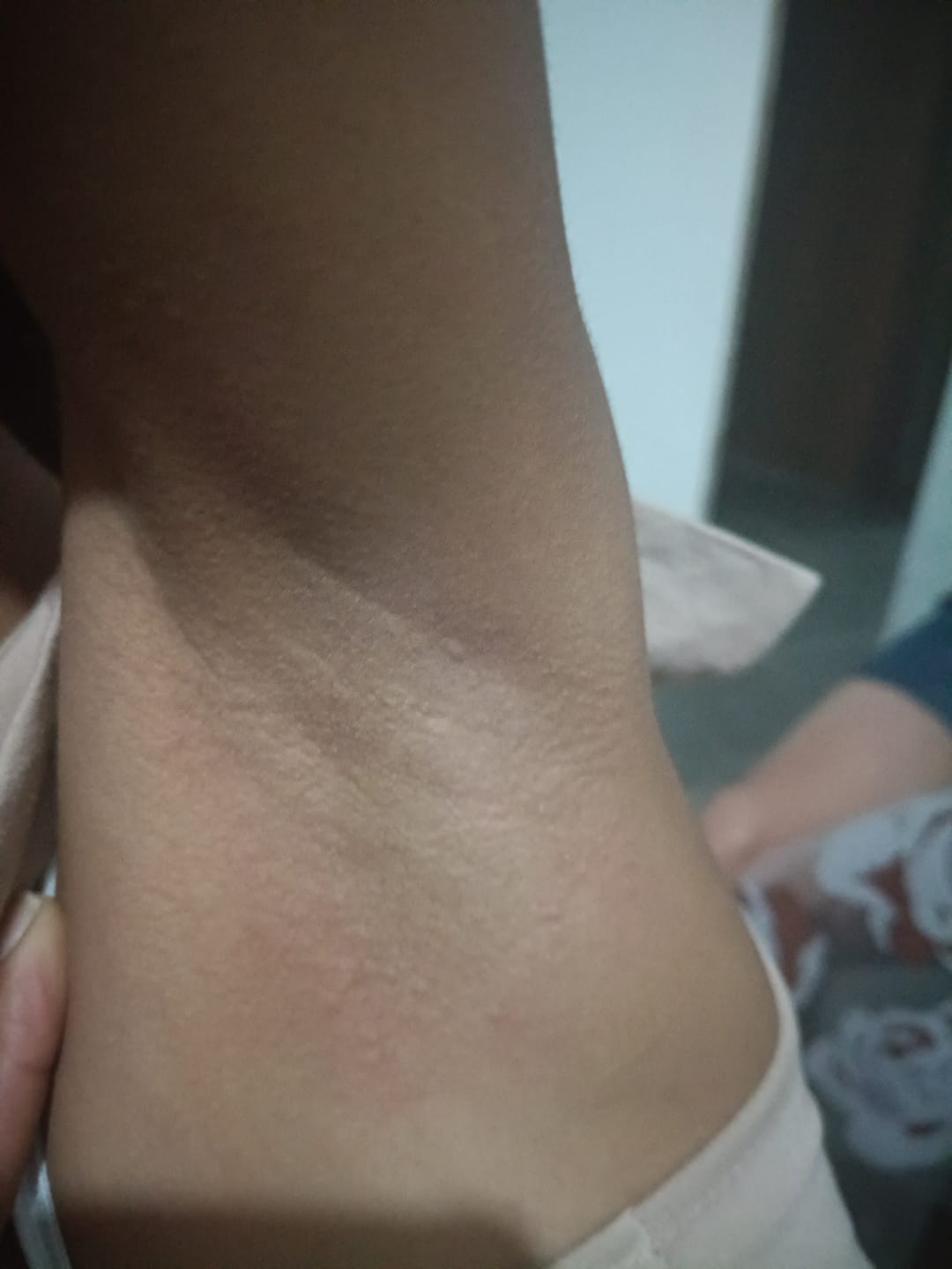 Customer photo review of Desodorante Purificante Teen