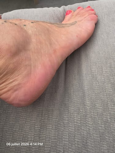 Customer photo review of Râpe Anti-Callosités Vantyx™ PRO