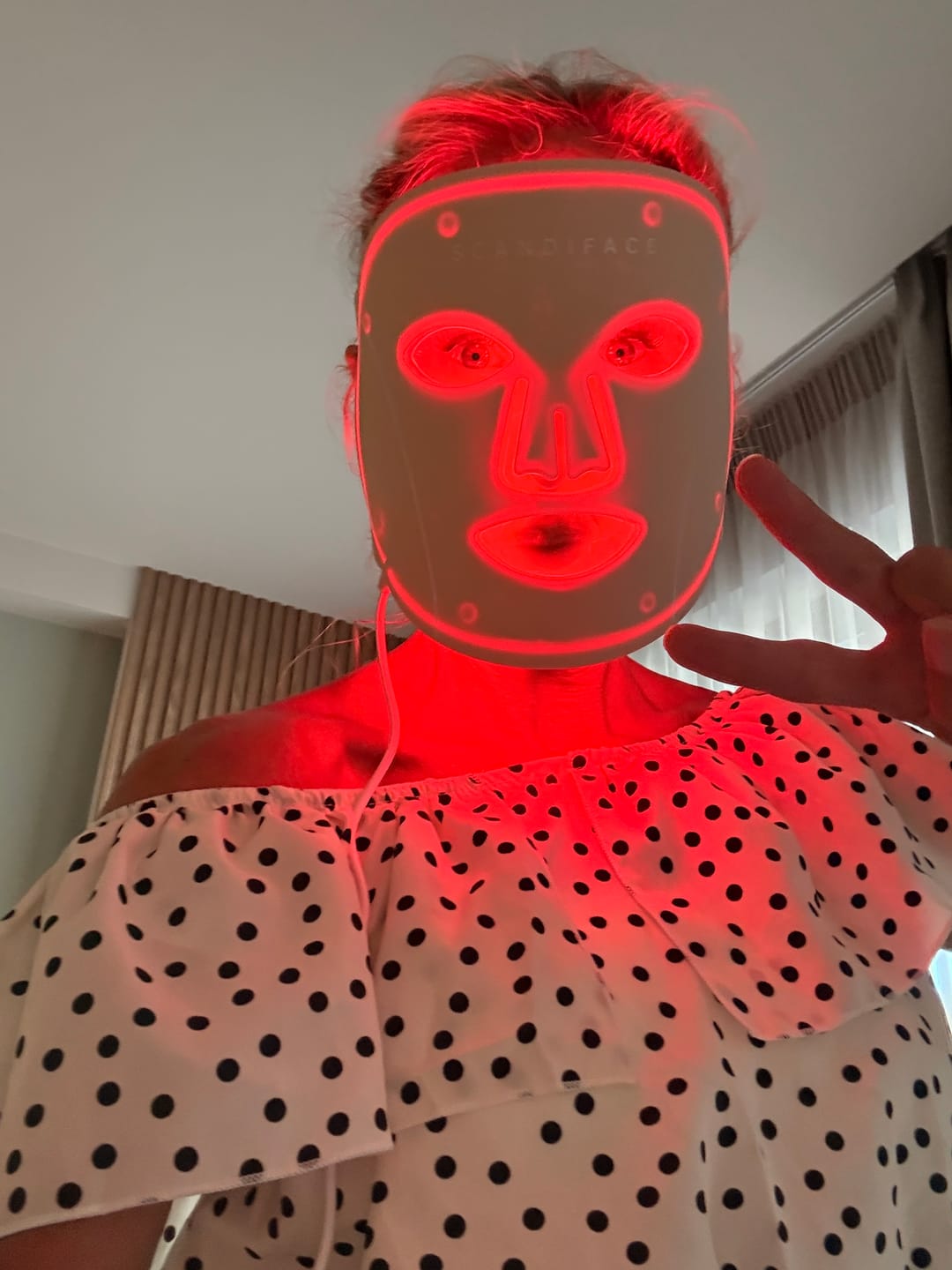 Customer photo review of Skinboosting LED mask