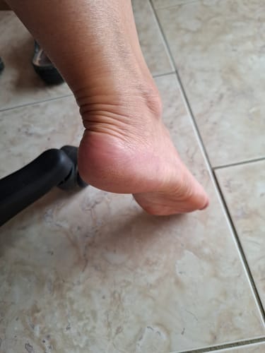 Customer photo review of Râpe Anti-Callosités Vantyx™ PRO