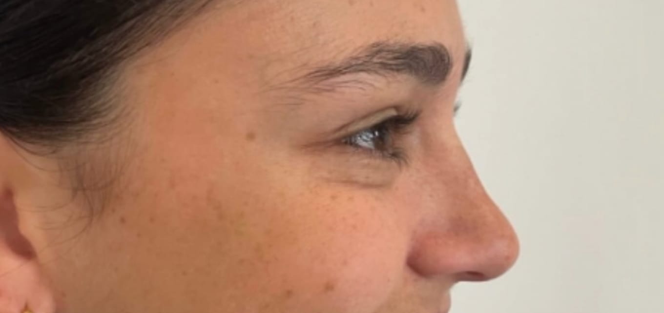 Customer photo review of Luelle Wrinkle Patches