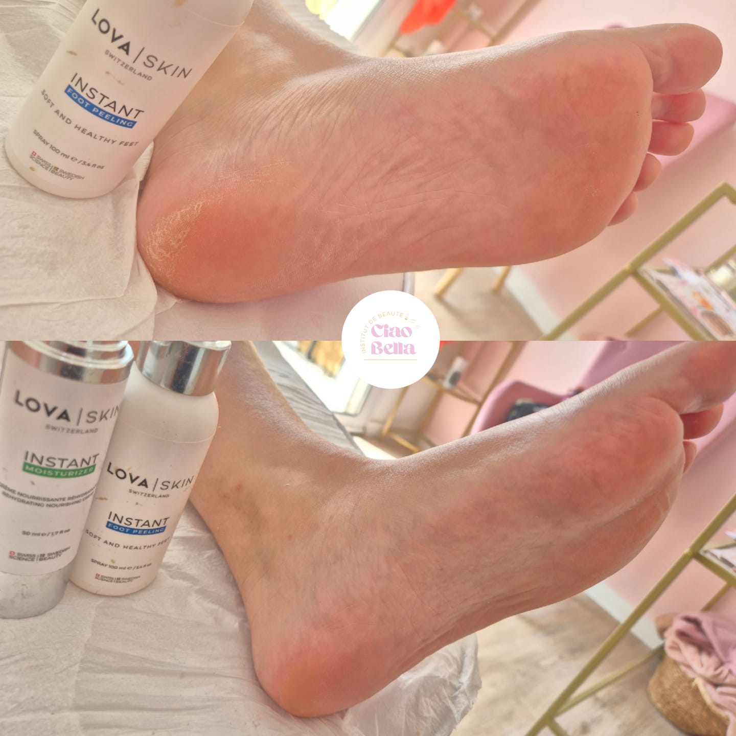 Customer photo review of LOVASKIN INSTANT FOOT PEEL Deluxe Kit - 25 applications in a bottle