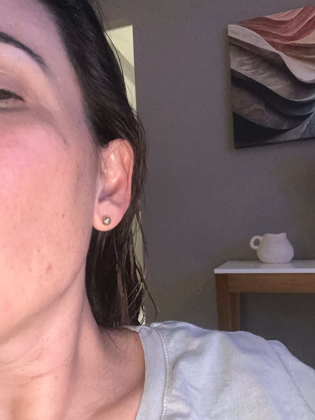 Customer photo review of Duo PDRN + Balm de Olhos