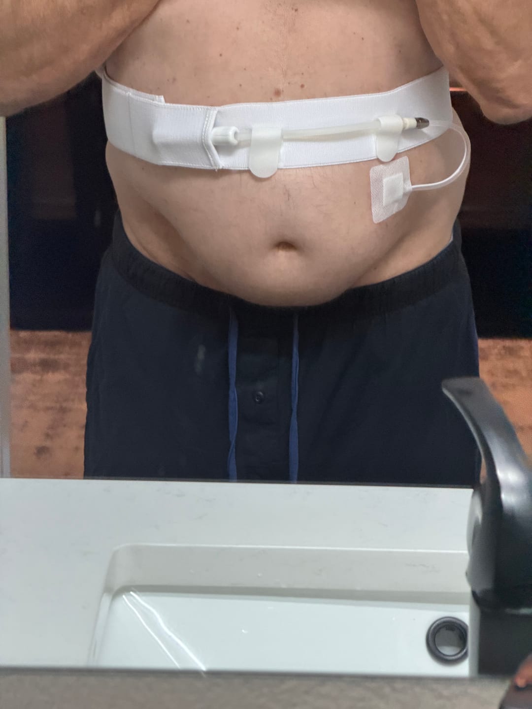 Customer photo review of Peritoneal Dialysis Belt (Individual)