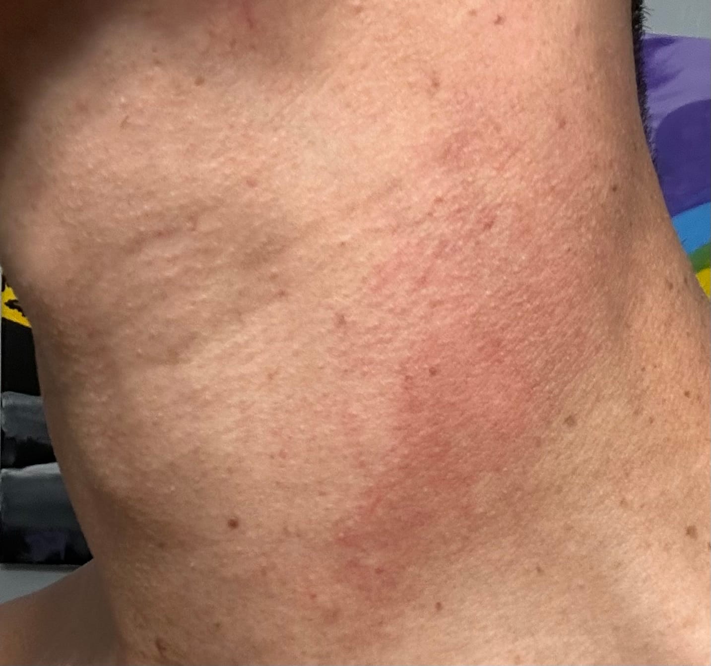 Customer photo review of Total Cranarchy Multi-Use Balm