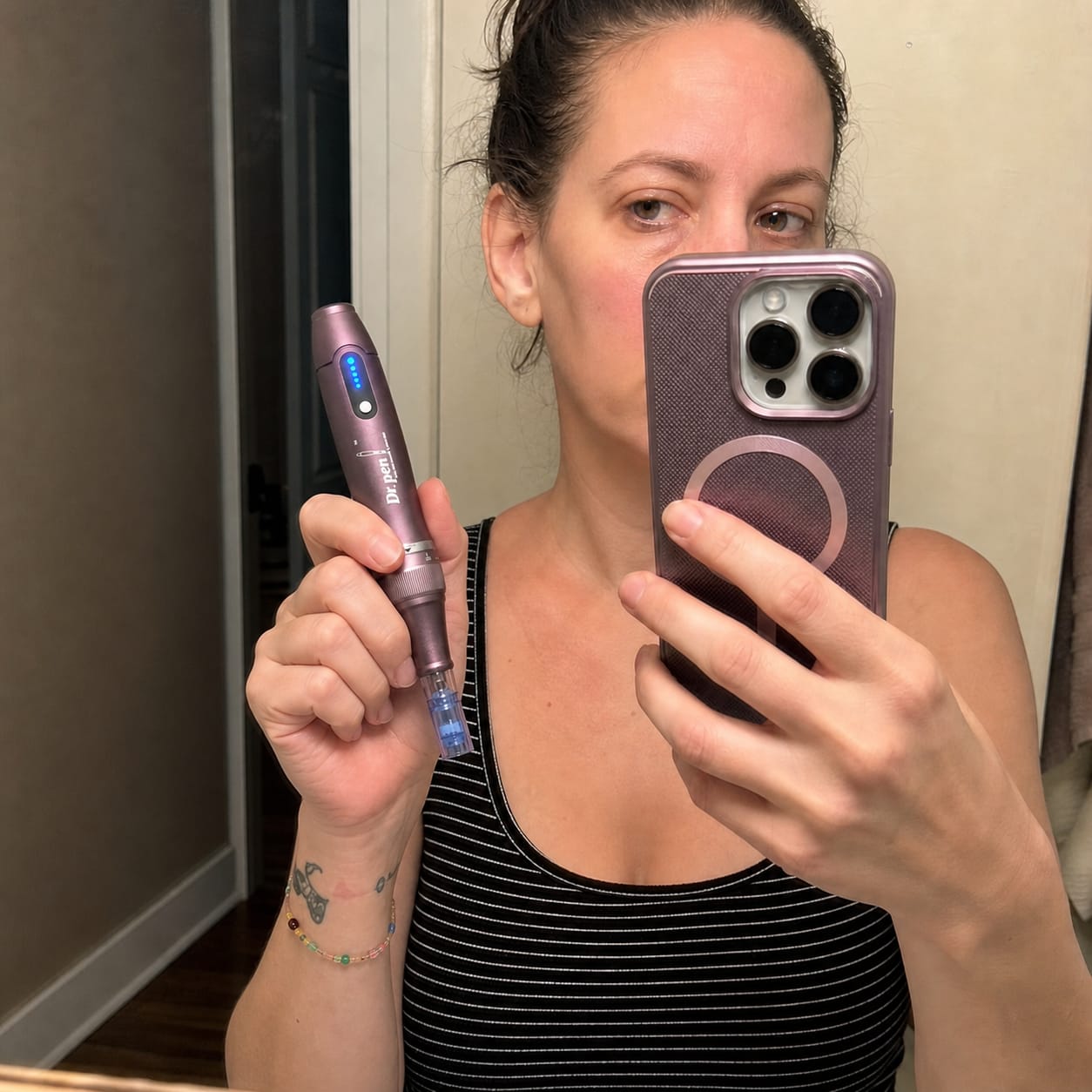 Customer photo review of Dr. Pen A10