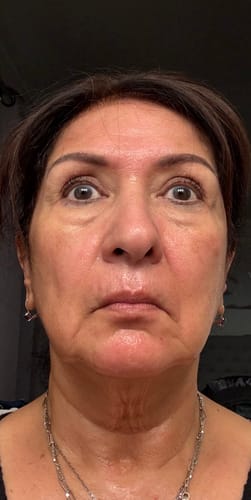 Reviewer's face showing smooth skin, shared as a testimonial for Deep Collagen Cream.