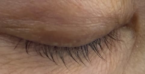 Customer photo review of Lash Serum