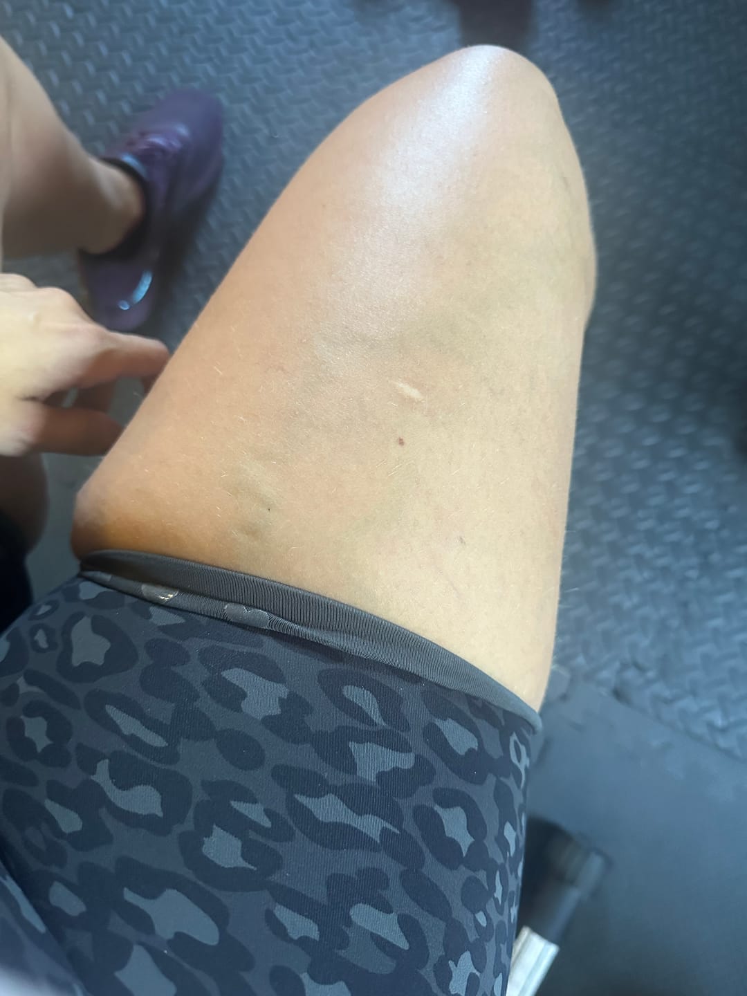 Customer photo review of Onset Short 2.0