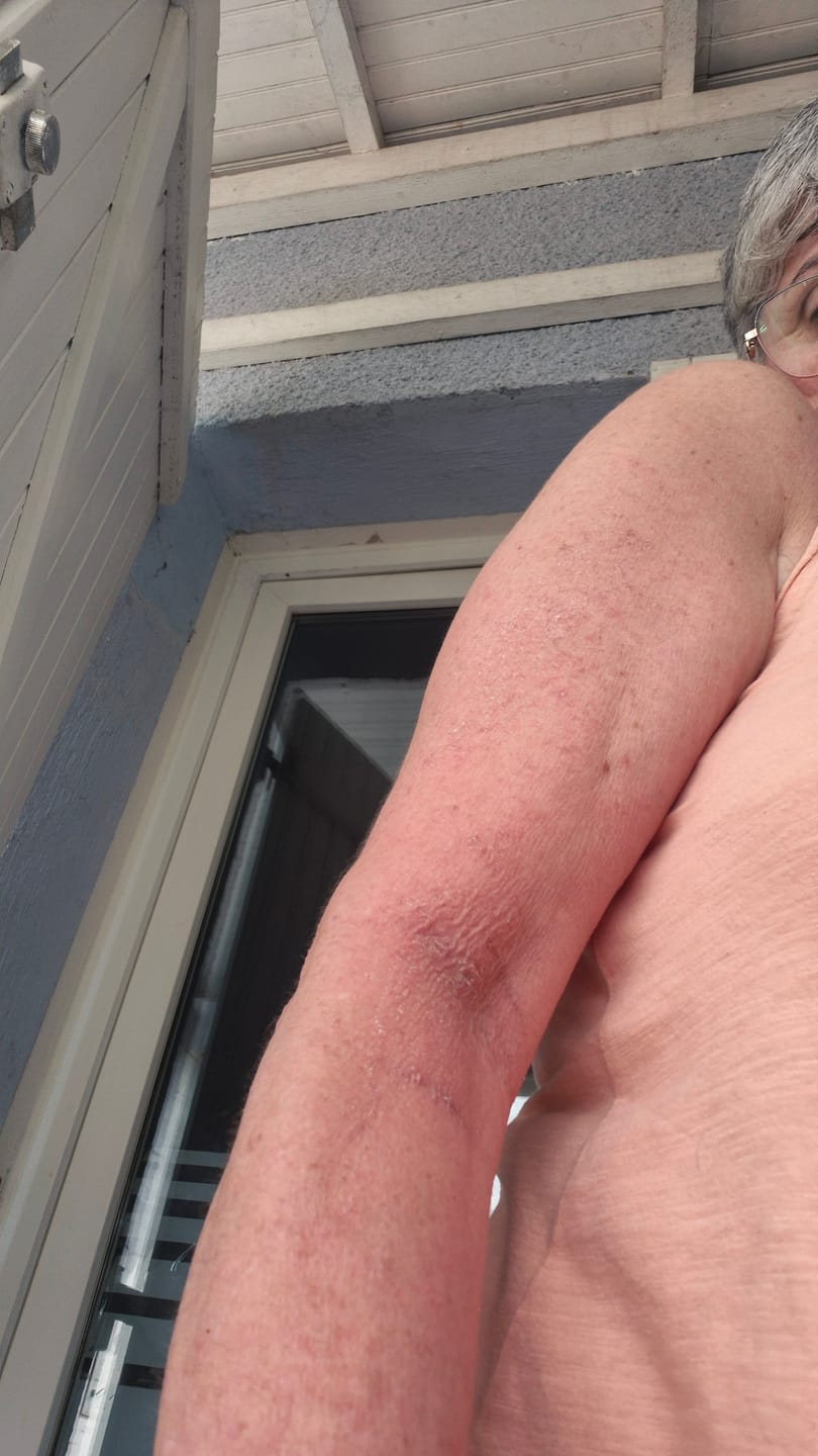 Customer photo review of Huile Liftante Anti-Rides Corps