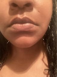 Customer photo review of CitraKiss™ Turmeric Lipstick