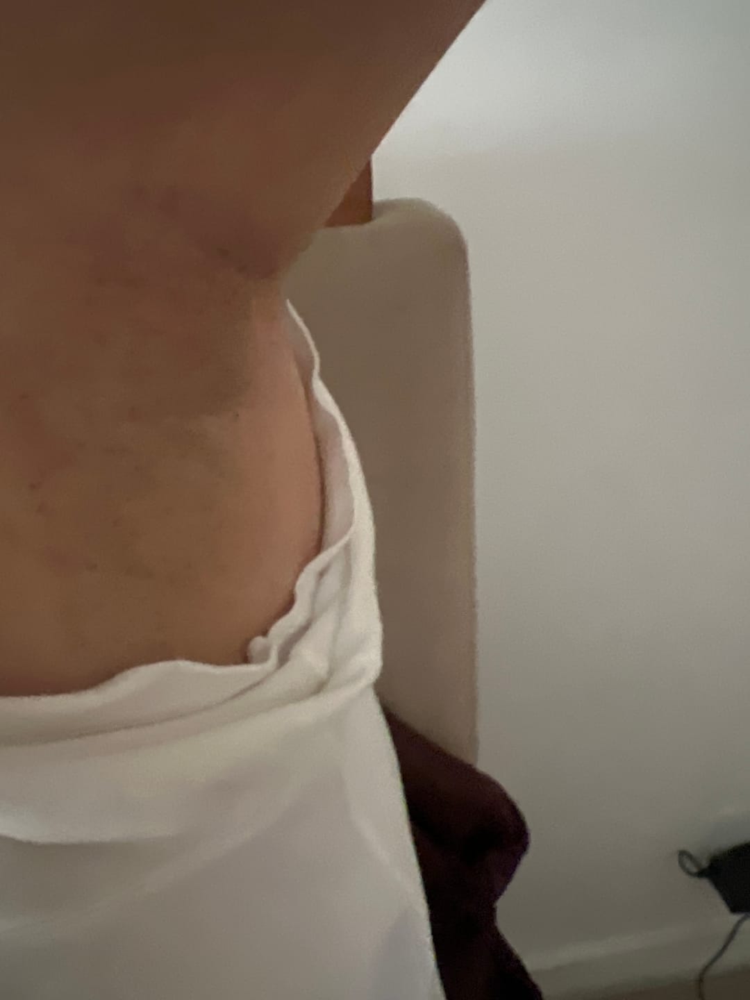 Customer photo review of Creme Clareador de Manchas – Melasma, Axilas, Virilha, Áreas Íntimas, Rosto e Corpo