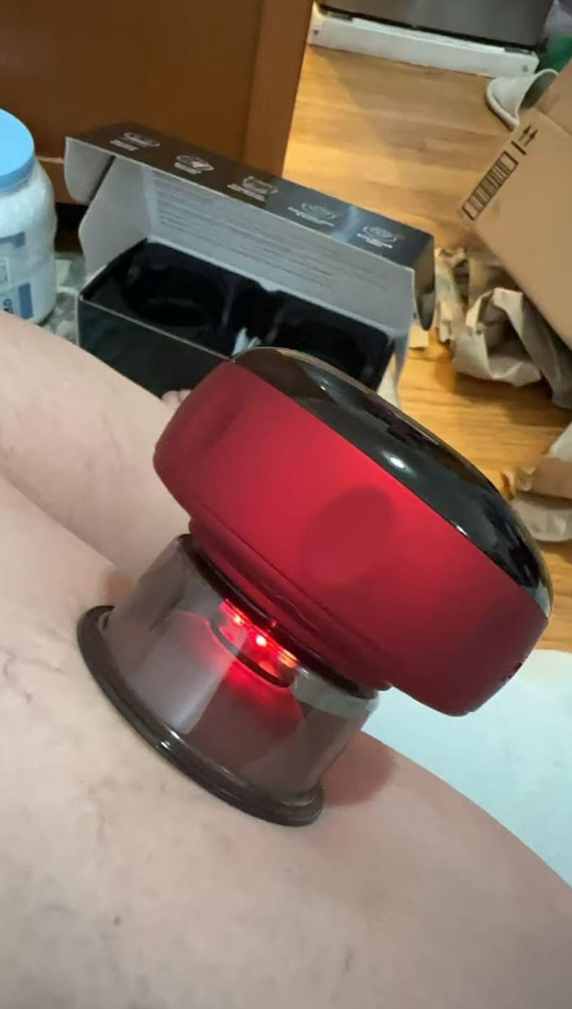 Customer photo review of CUPPING MASSAGE JARS