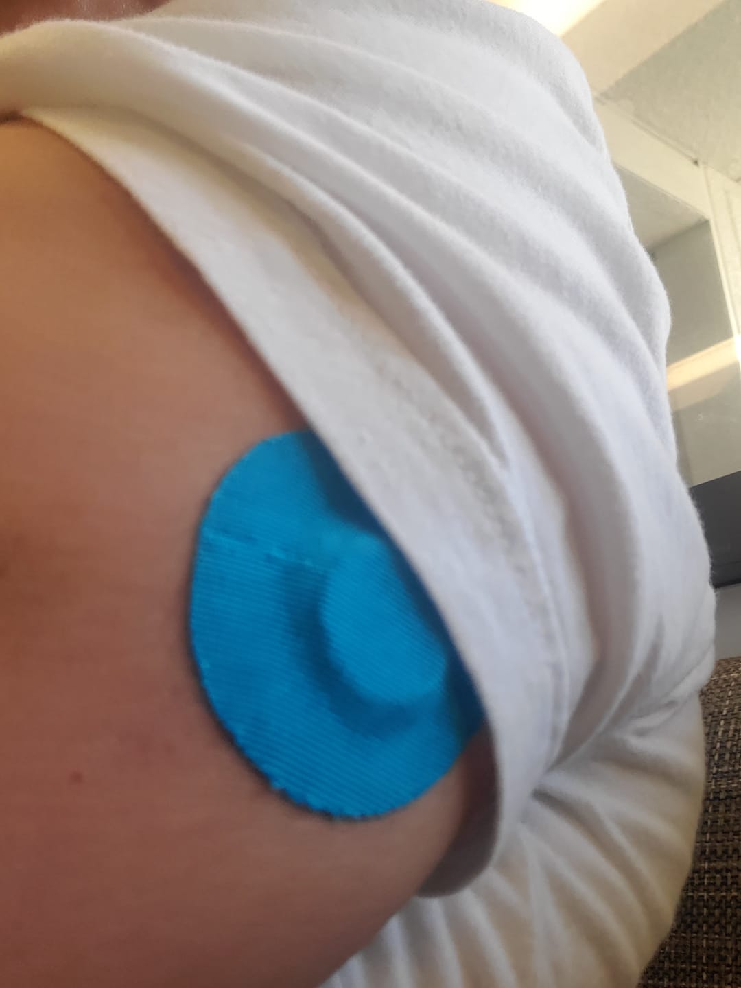Customer photo review of Skin Grip Original - Libre 3+ Adhesive Patches