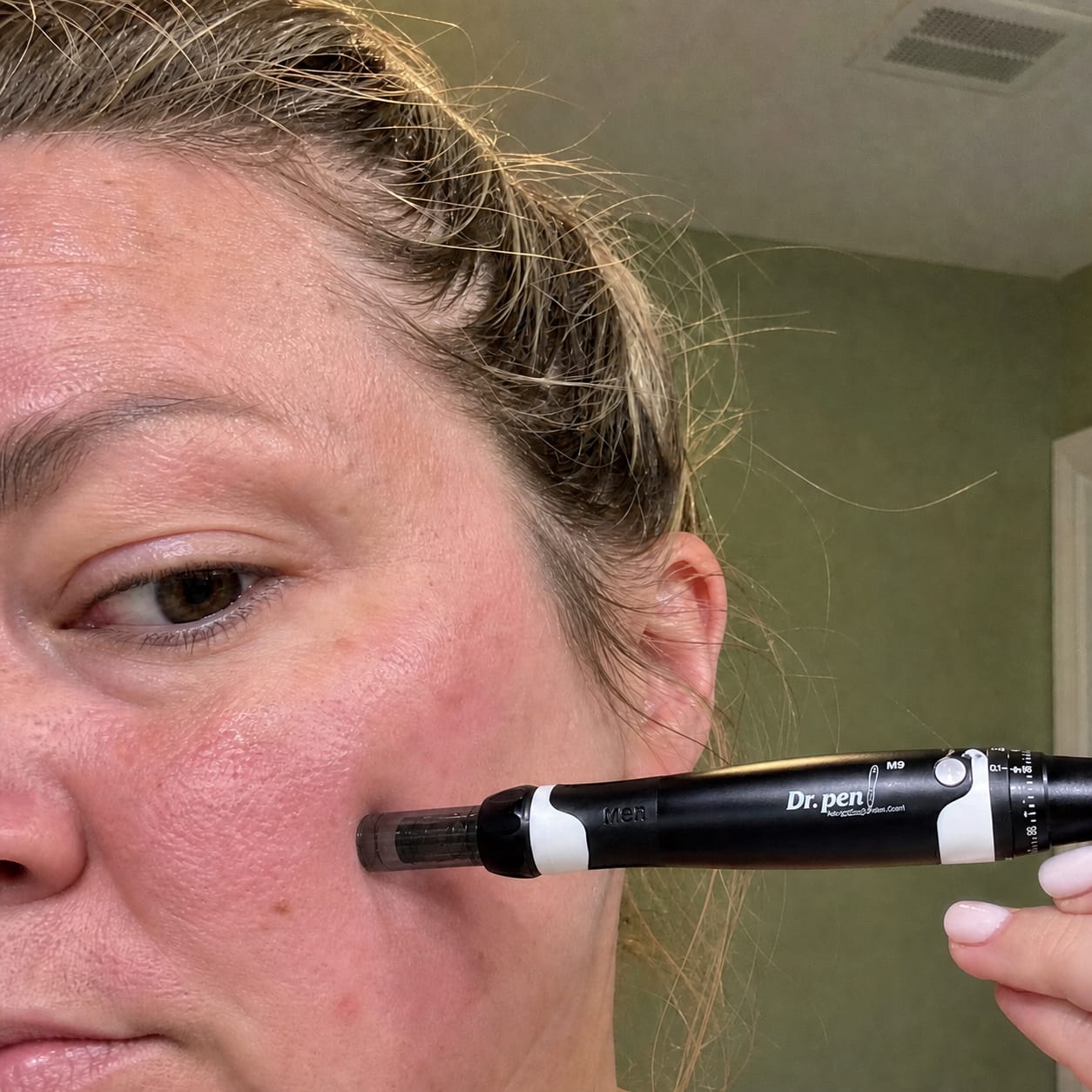 Customer photo review of Dr. Pen A7