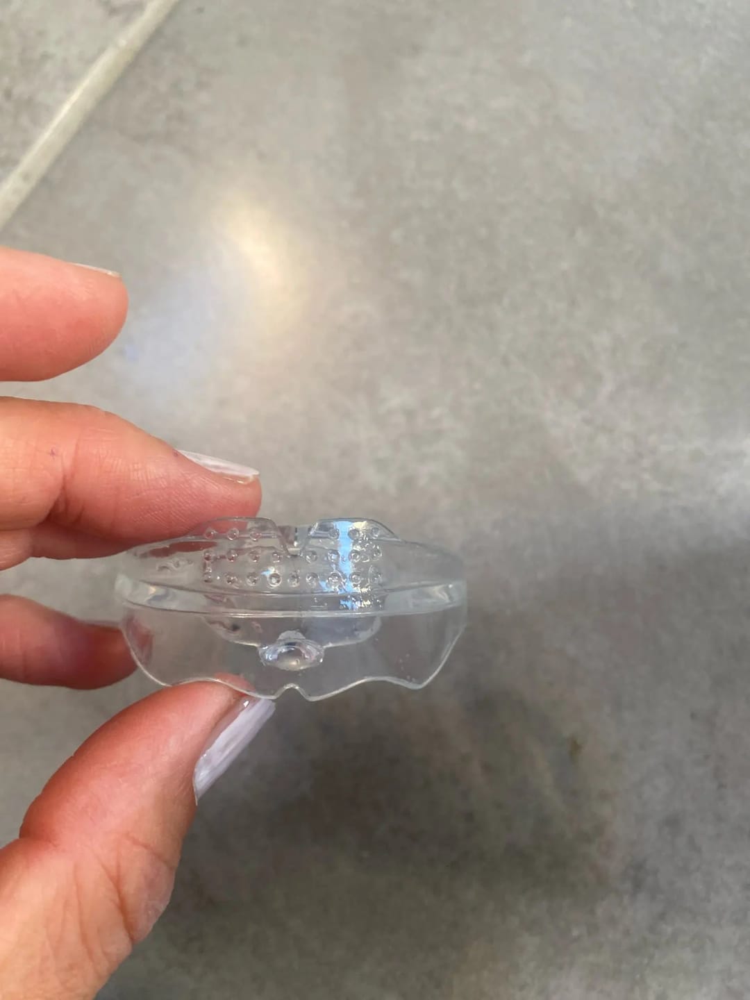 Customer photo review of Ortmedy™ Align