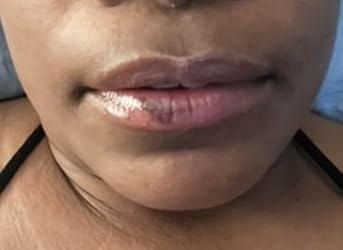 Customer photo review of CitraKiss™ Turmeric Lipstick
