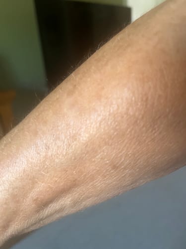 Reviewer's soft, moisturized skin on their arm after applying the Body Serum.