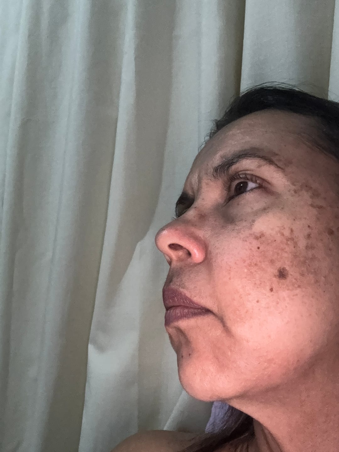 Customer photo review of Creme Clareador de Manchas – Melasma, Axilas, Virilha, Áreas Íntimas, Rosto e Corpo