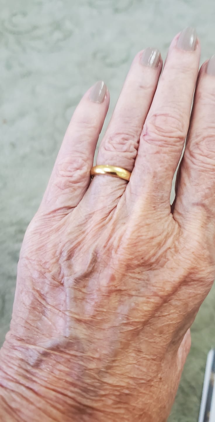 Customer photo review of Gold 4mm Wonder Ring