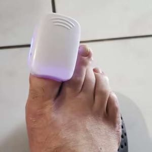 Customer photo review of LightCare Pro™ körömápoló készülék