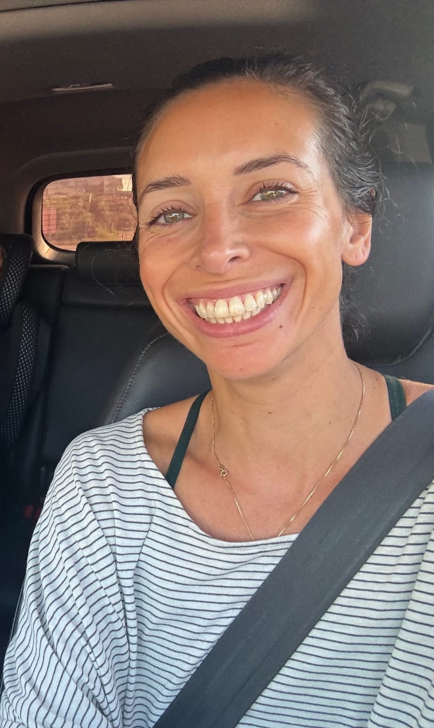 Customer photo review of BioCream: Anti-Aging Skincare with Leucomethylene Blue - Botanic Ingredients - Full Spectrum Protection - 100% Organic