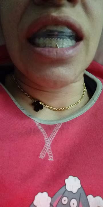Customer photo review of Ortmedy™ Align
