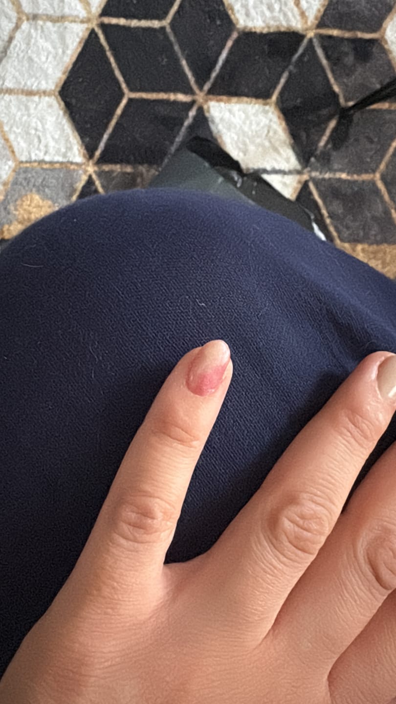 Customer photo review of N Misty Blossom Jel Tırnak 30 Adet, 2 Kullanım