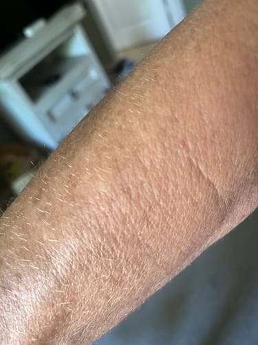 Customer's smooth, hydrated arm skin after using the Body Serum.