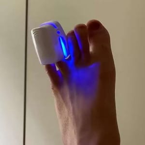 Customer photo review of LightCare Pro™ körömápoló készülék
