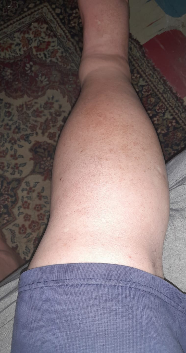 Customer photo review of Günlük Kullanım İçin Destekleyici Kompresyon Çorabı
