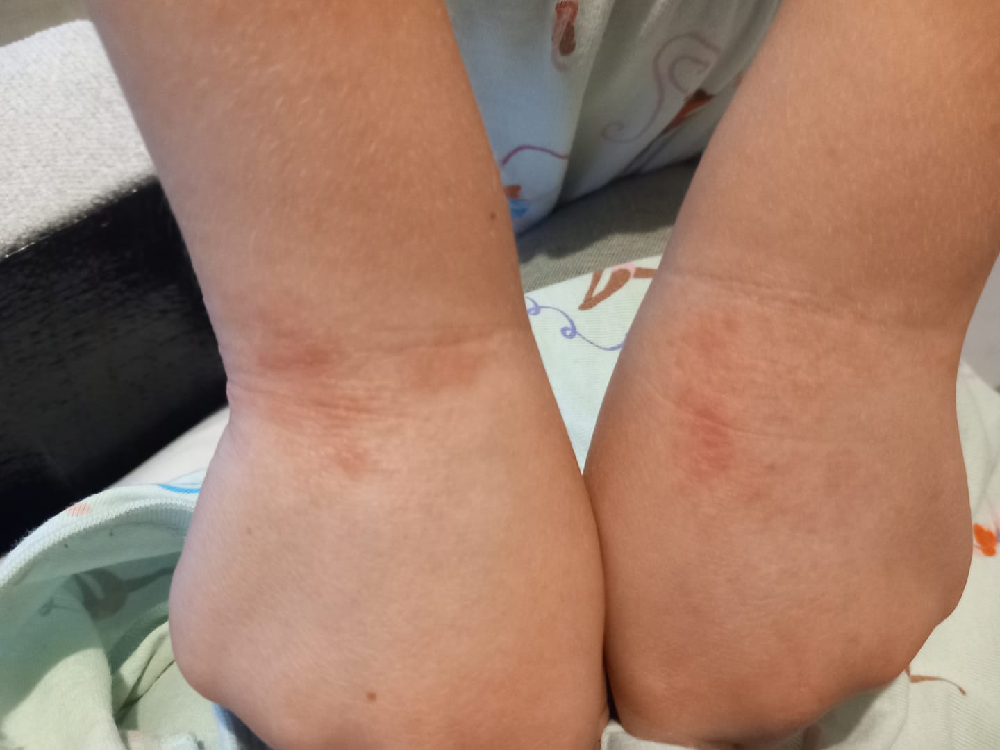 Customer photo review of Bioskin Junior Duo Pack