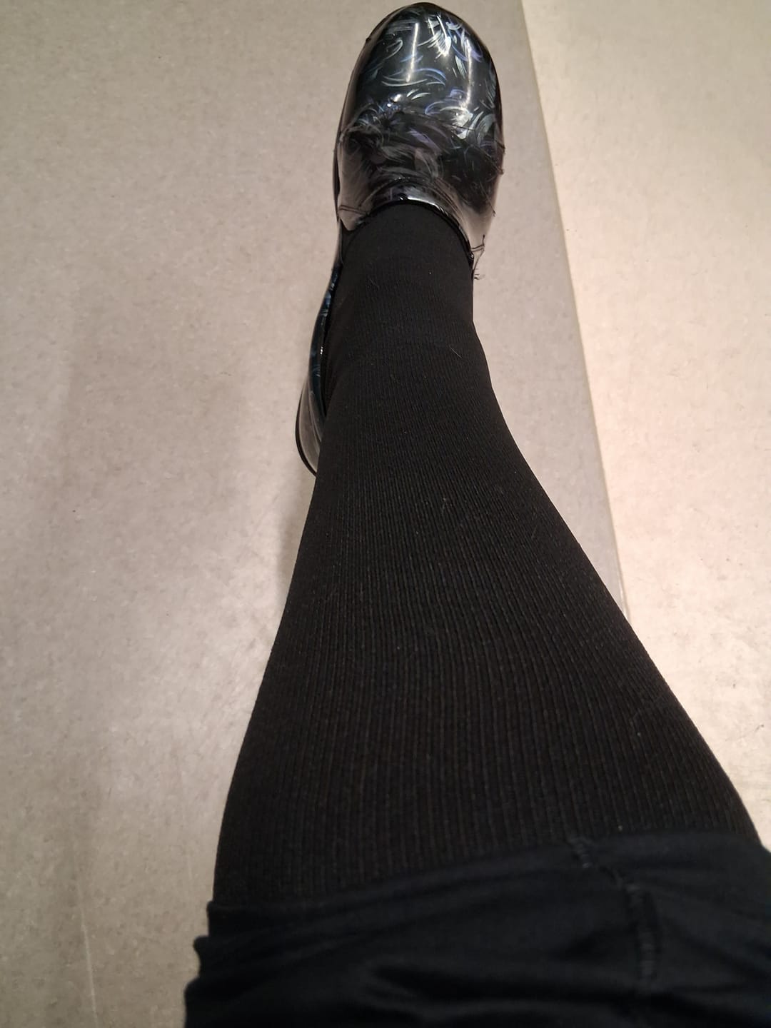 Customer photo review of Original Wide Compression Socks