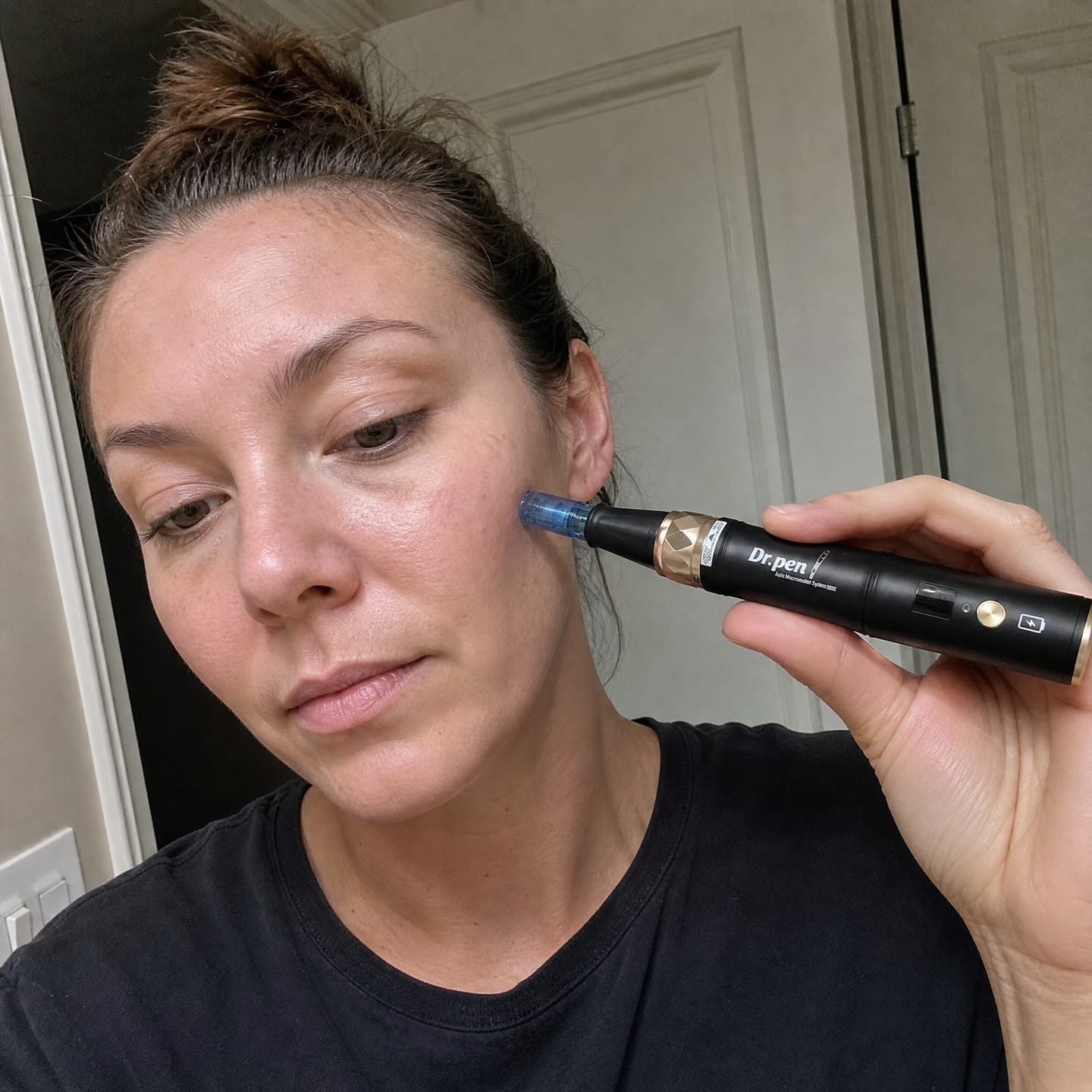 Customer photo review of Dr. Pen A8S