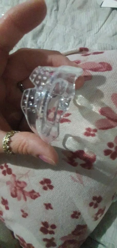 Customer photo review of Ortmedy™ Align