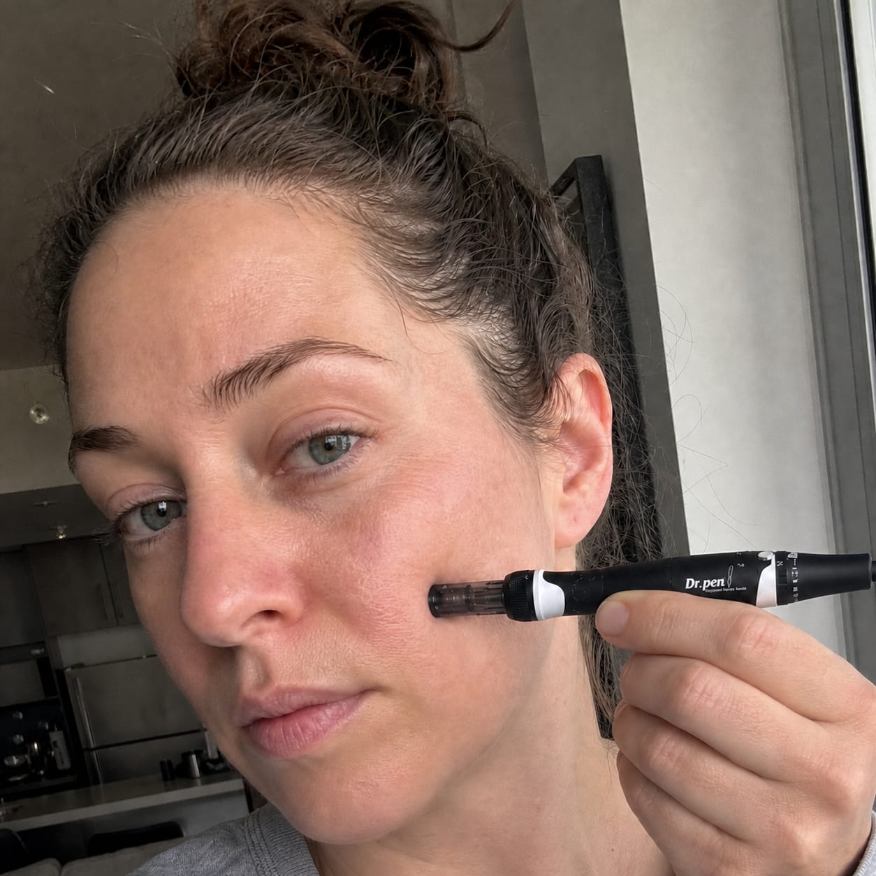 Customer photo review of Dr. Pen A7