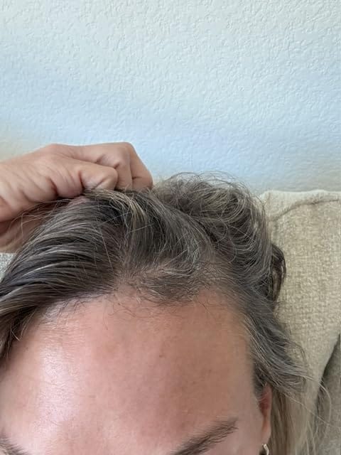 Customer photo review of Rosemary Rice Water Hair Spray