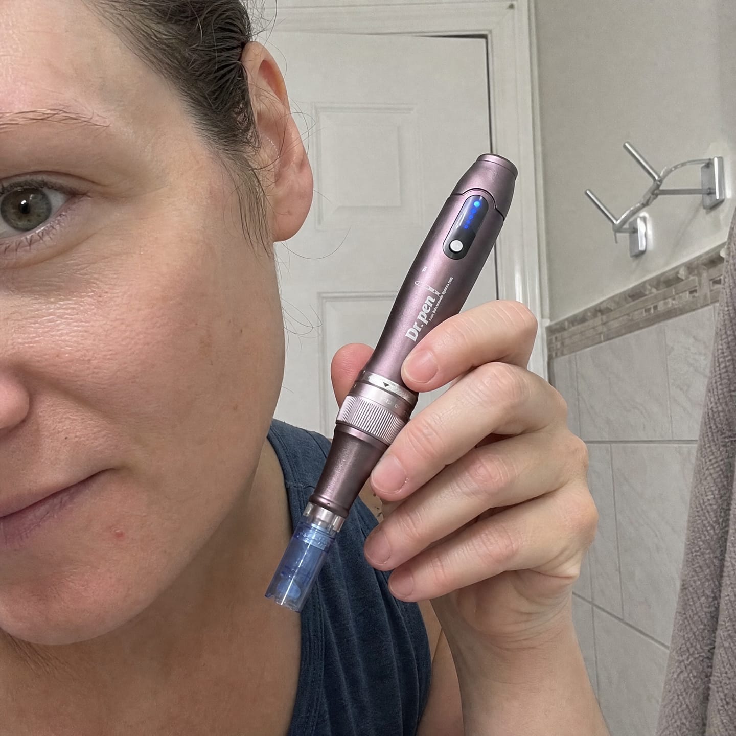 Customer photo review of Dr. Pen A10