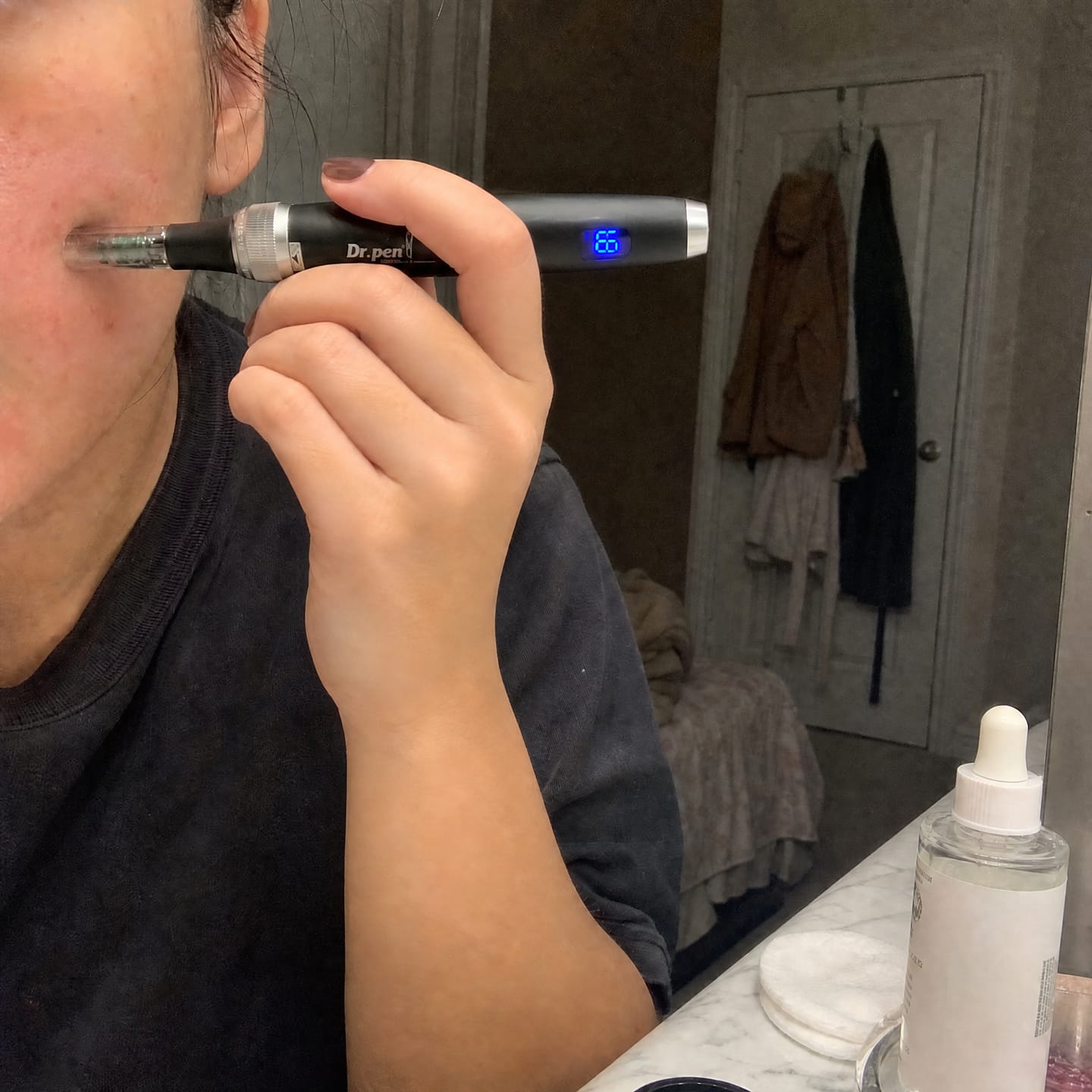 Customer photo review of Dr. pen M7S
