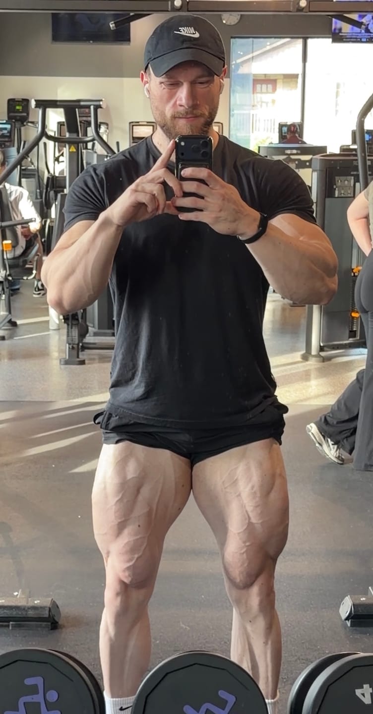 Customer photo review of 101 Bodybuilding Short Shorts