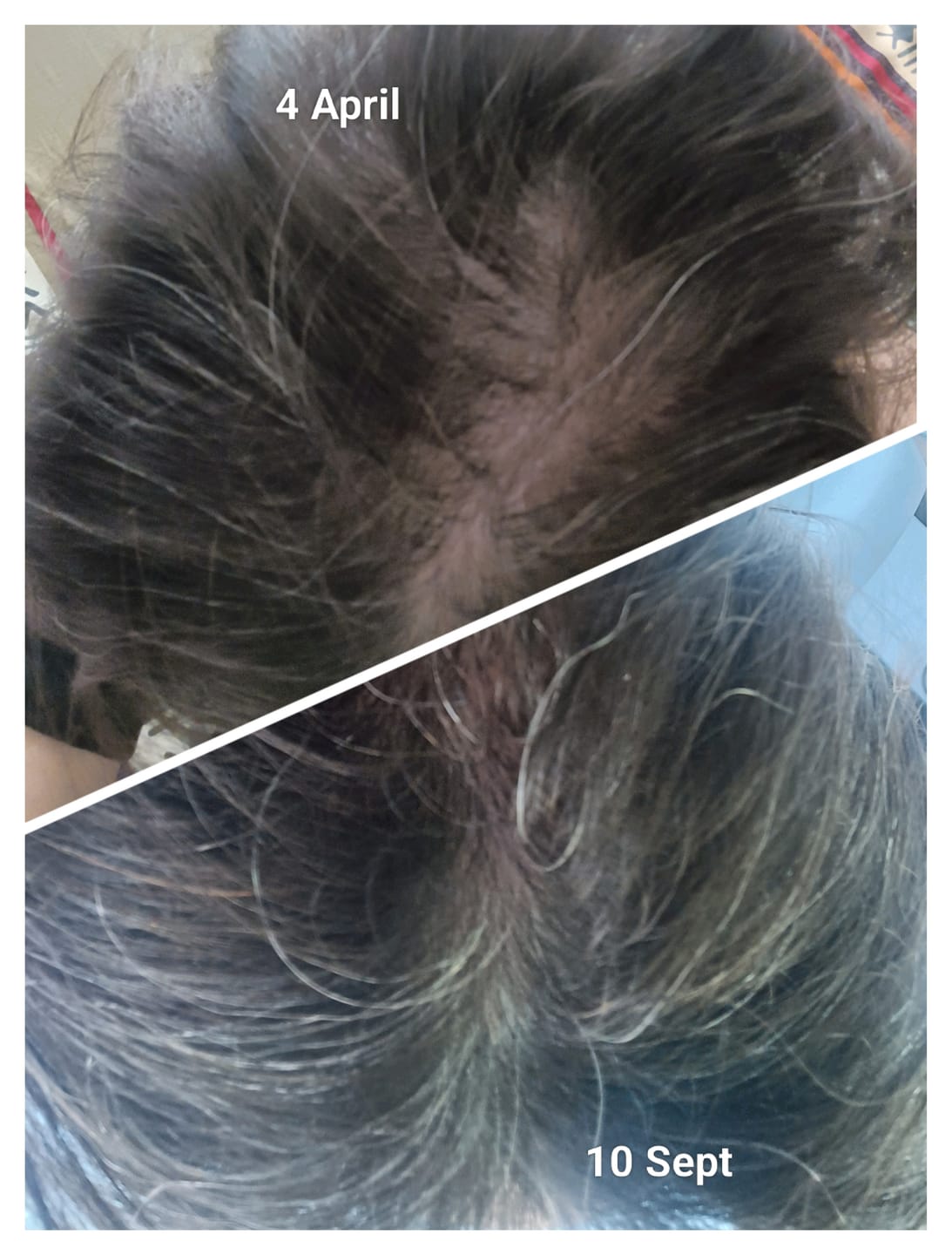 Customer photo review of Hair & Nail Capsules