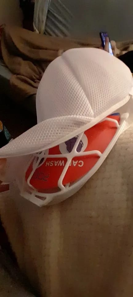Customer photo review of Jedaaly™ Cap Washer