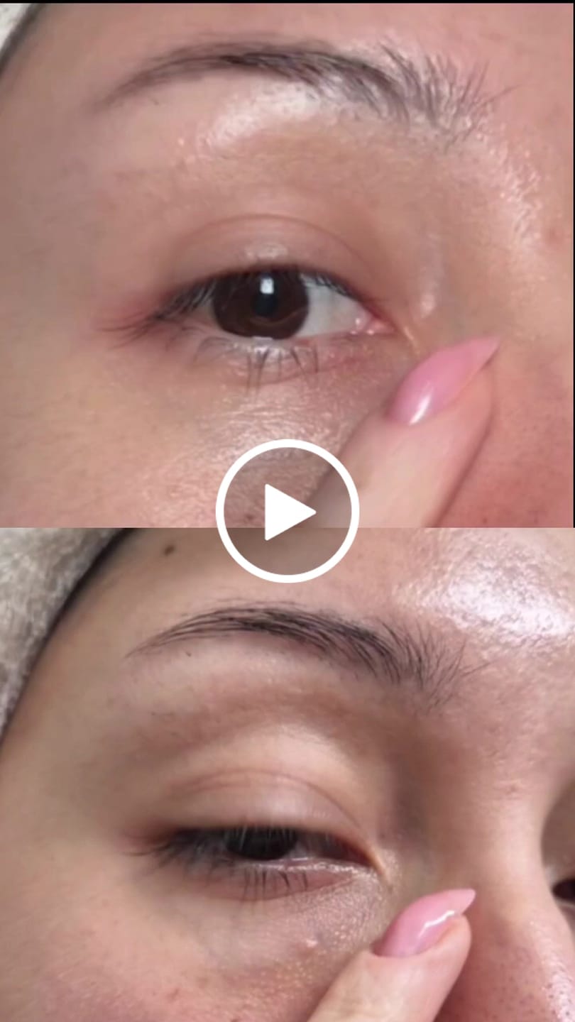 Customer video review of 360º Shot PDRN lifting Eye cream 30ml