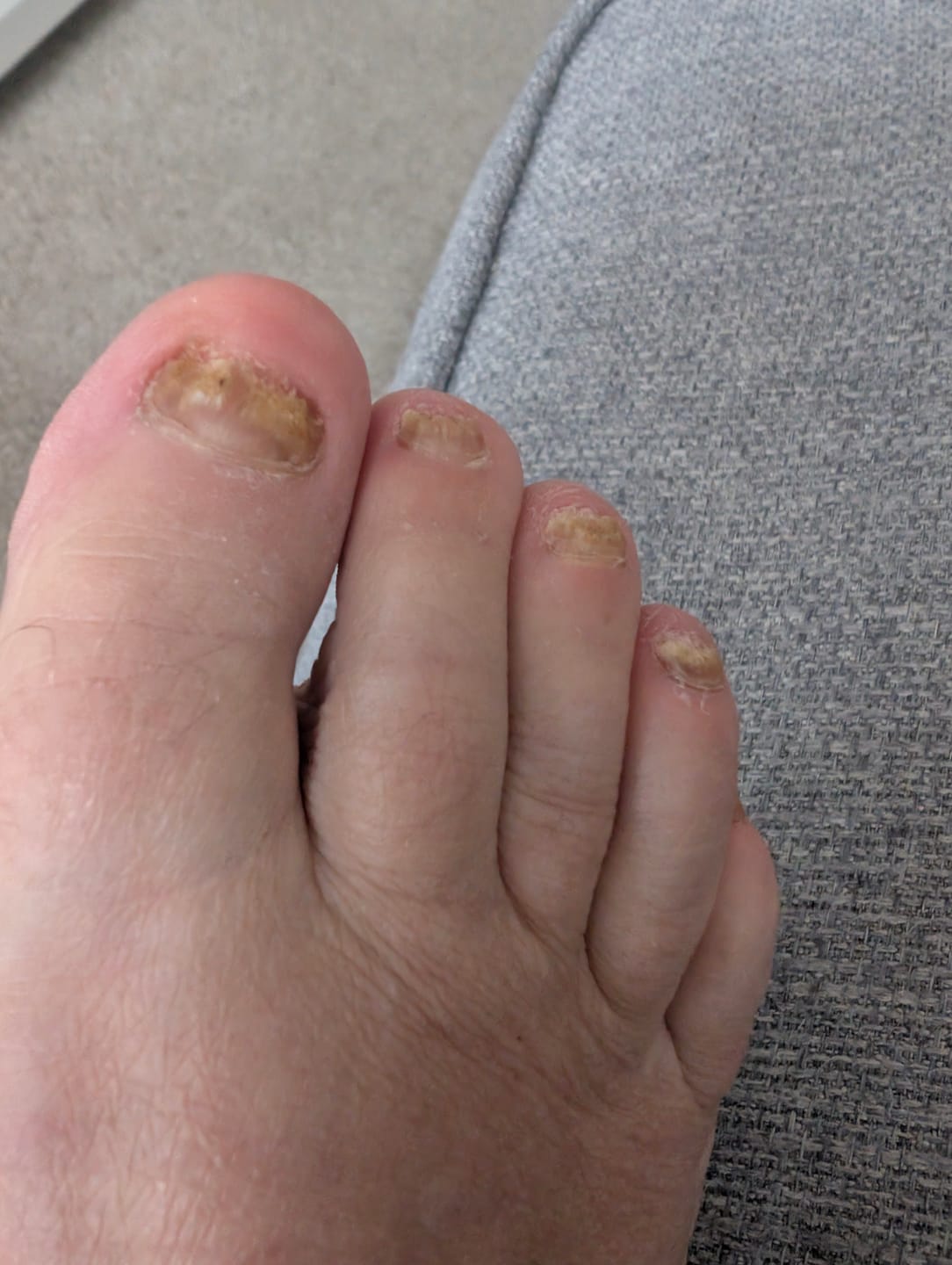Customer photo review of Fungal Freedom