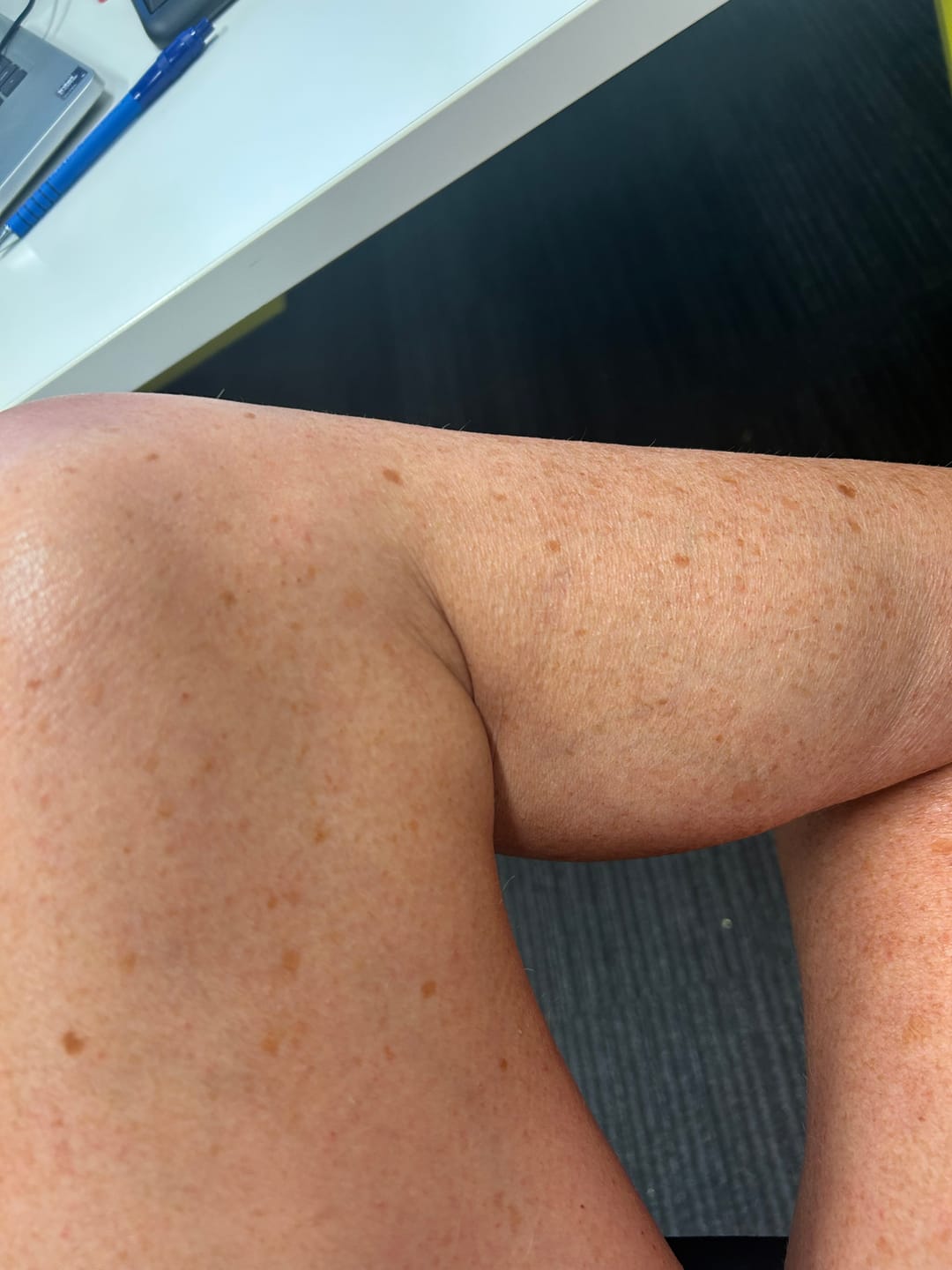 Customer photo review of Self Tanning Foam