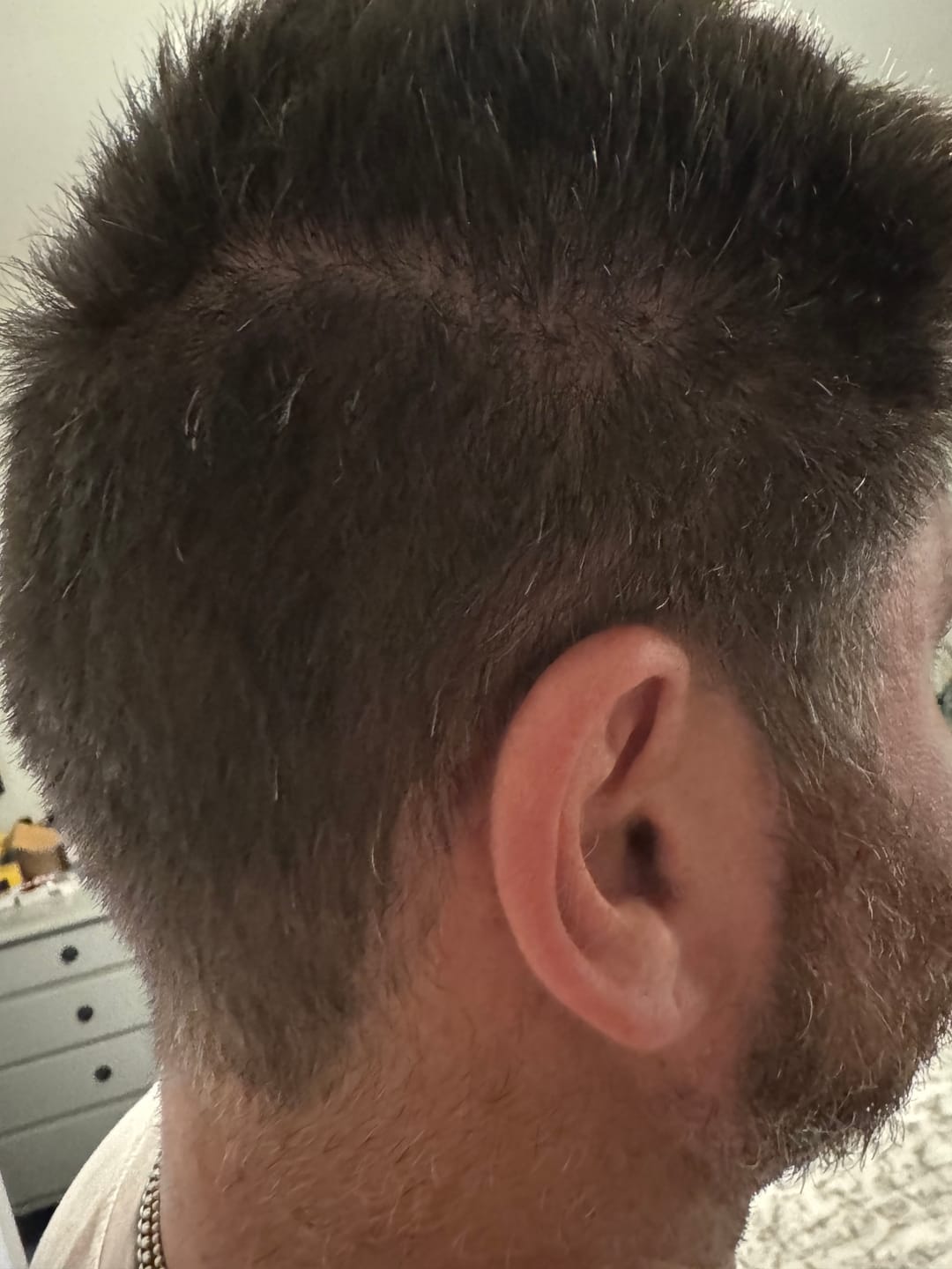 Customer photo review of Seb Natural Calming Serum