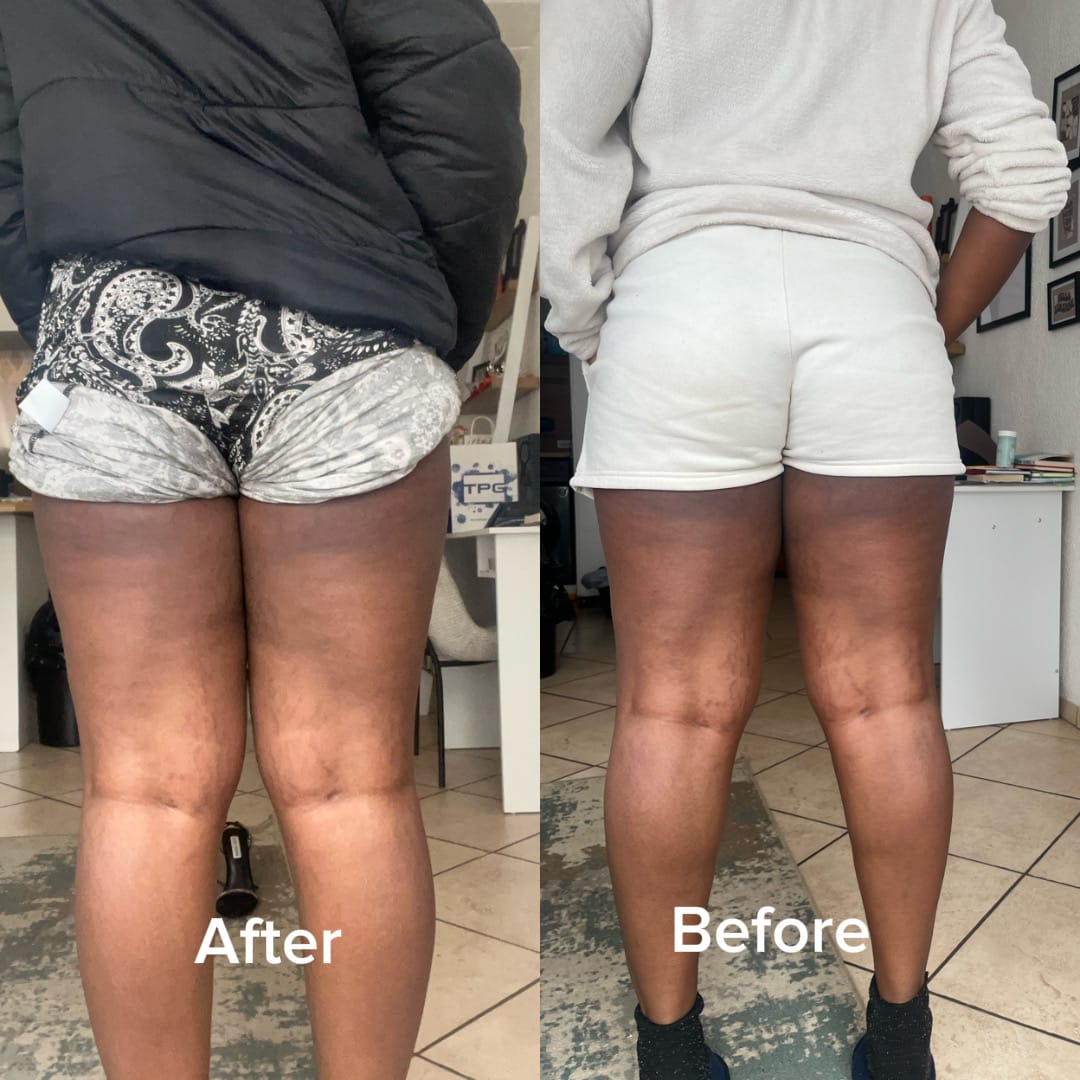 Customer photo review of Glow Getter