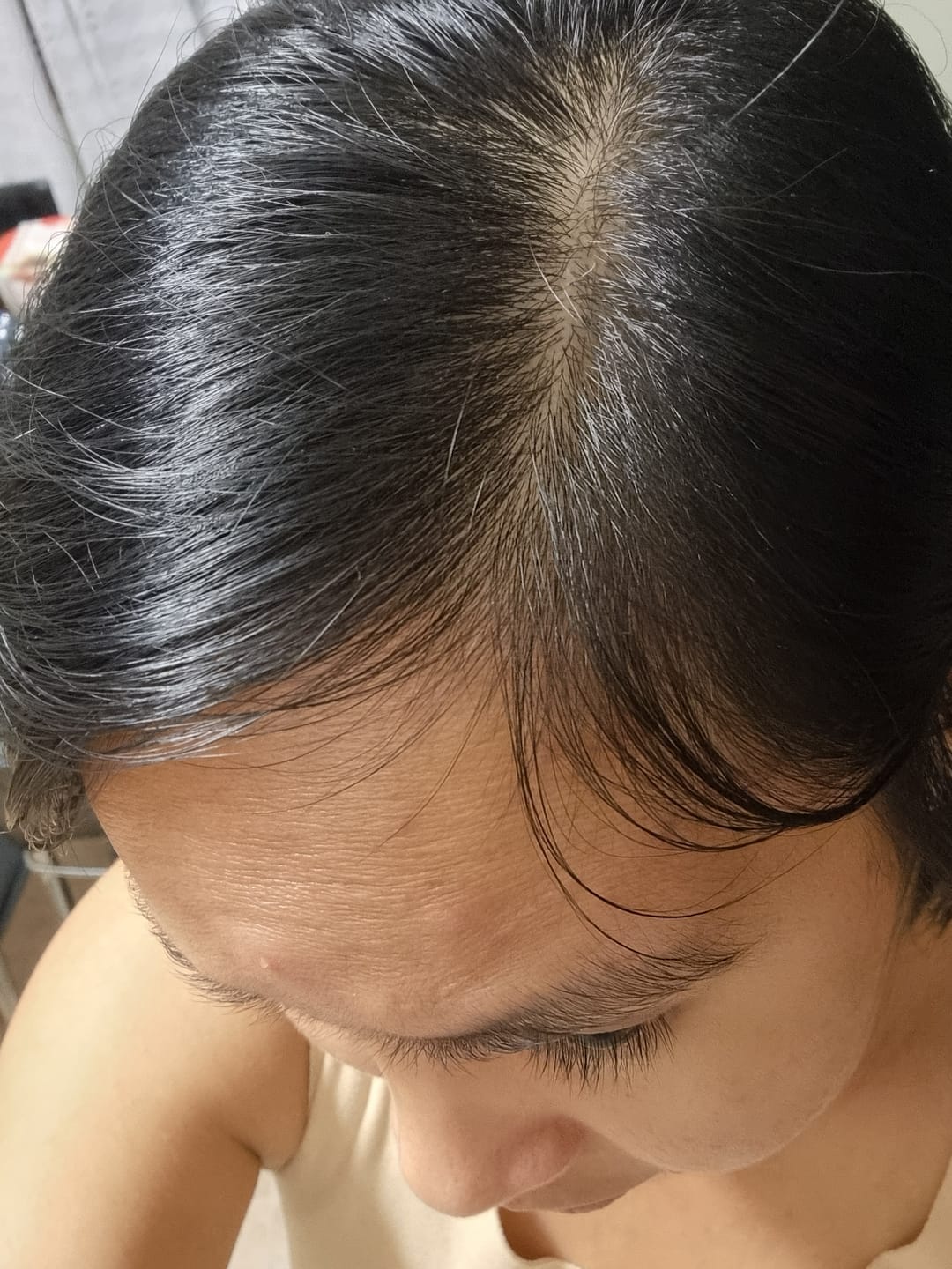 Customer photo review of Rosemary & Castor Hair Oil