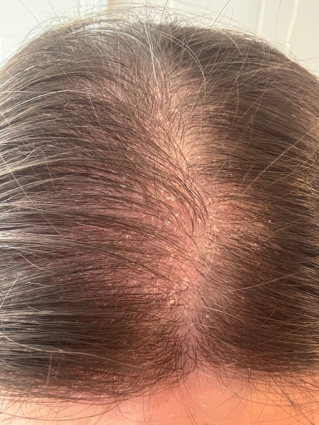 Customer photo review of Seb Natural Calming Serum