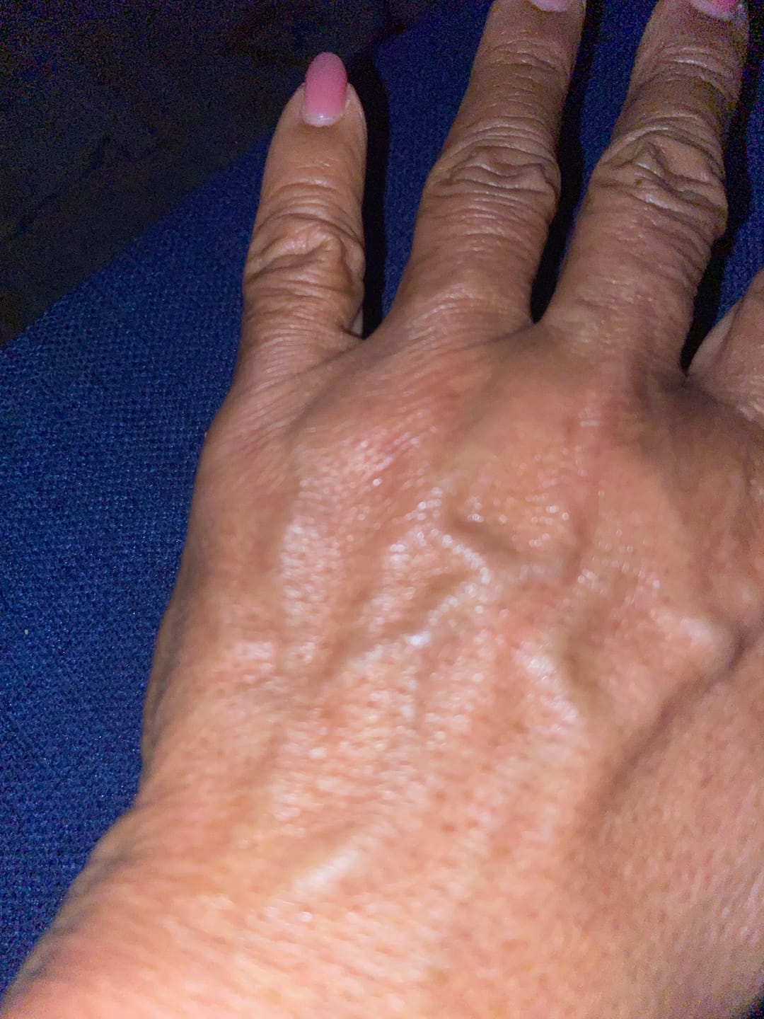Customer photo review of 300mg CBN + 300mg CBD Gummies – Blood-Orange Sleep Support